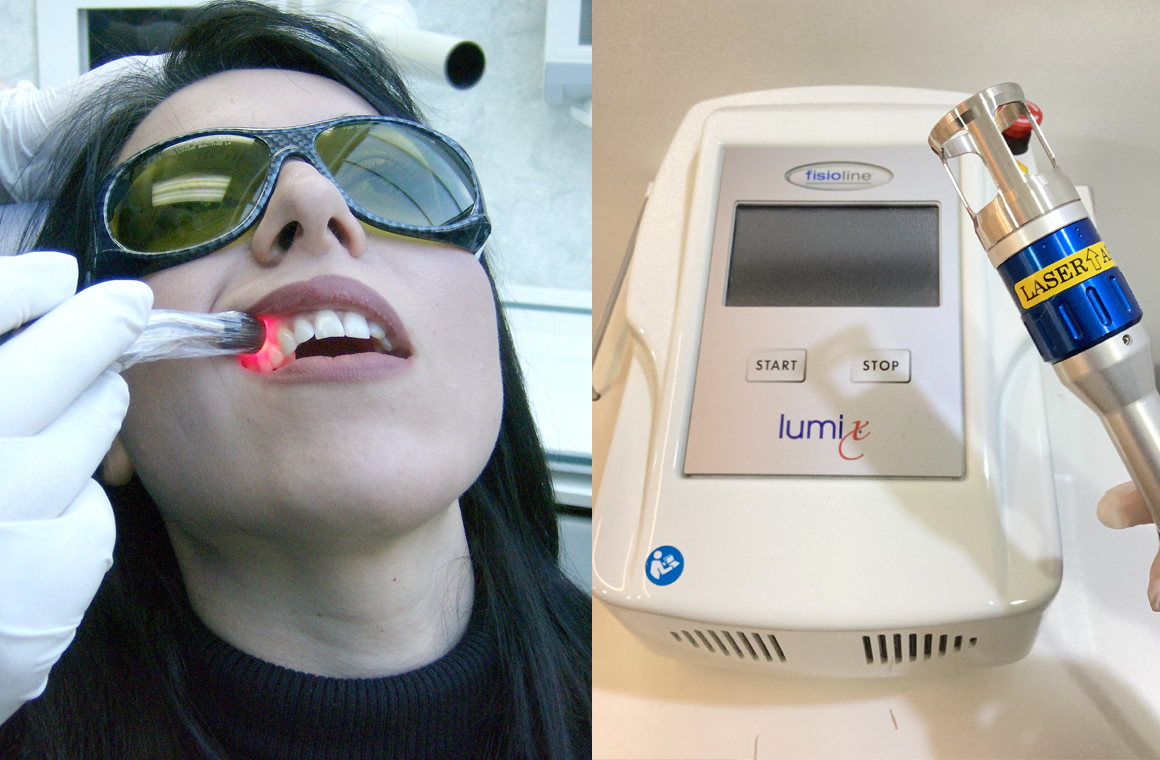 コールドレーザールミックス2